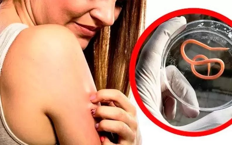 денедегі паразиттерге байланысты қышу және тітіркену