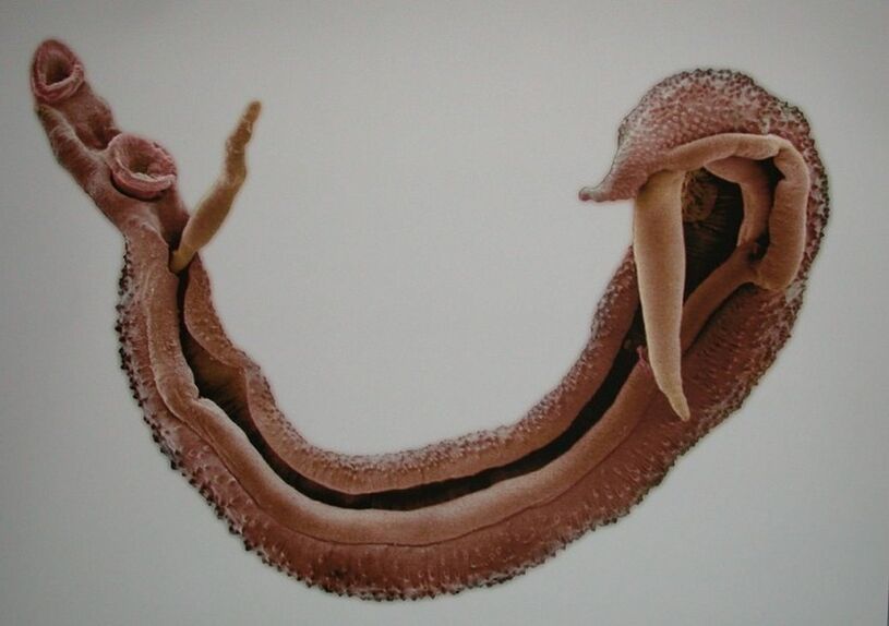 Шистосомалар - адам қанындағы қауіпті паразит