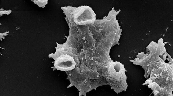 Negleria fowlera — адам өміріне қауіпті қарапайым паразит. 