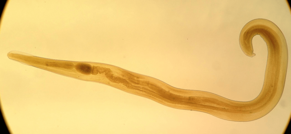 Pinworm - балалар арасында кең таралған паразит. 